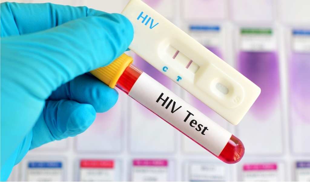 En Salta se se detectan casos de VIH e infecciones de transmisión sexual en adolescentes desde los 14 años