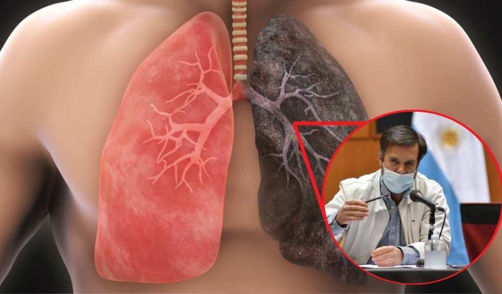 Cáncer de pulmón en Salta: Alerta por los riesgos del cigarrillo, el vapeo y el humo de leña