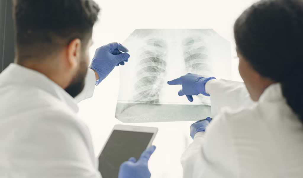Alerta: Los casos de tuberculosis aumentaron un 65% en Argentina en 5 años
