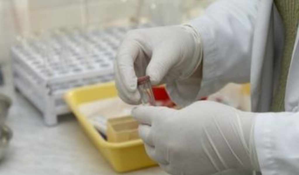 Exámenes toxicológicos para funcionarios: "El consumo de hoja de coca puede arrojar un resultado positivo para cocaína", afirmó una bioquímica