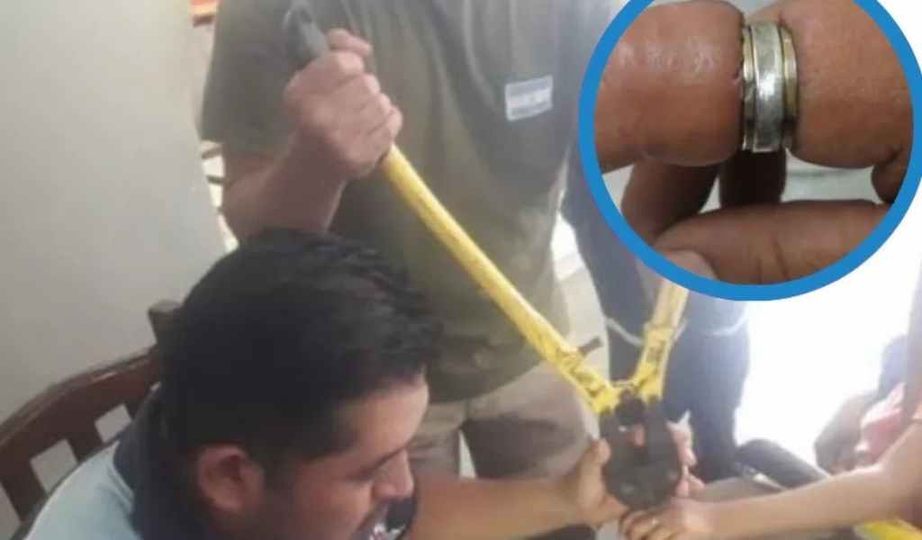 Estos accidentes son muy comunes: En Orán los bomberos sacaron a 30 vecinos anillos que se trabaron en sus dedos