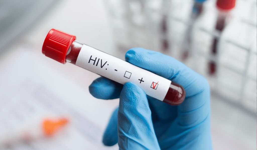 Los nuevos diagnósticos de VIH en Salta se dan en varones jóvenes de 15 a 19 años