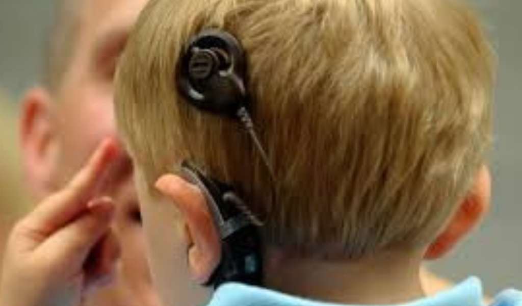 El Ministerio de Salud de Salta logró que 12 salteños sin obra social recuperen la audición en el último año a través de implantes cocleares