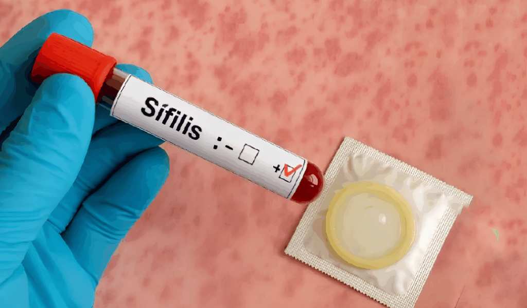 Preocupación en Salta por el aumento de casos de sífilis, con fuerte impacto en los jóvenes