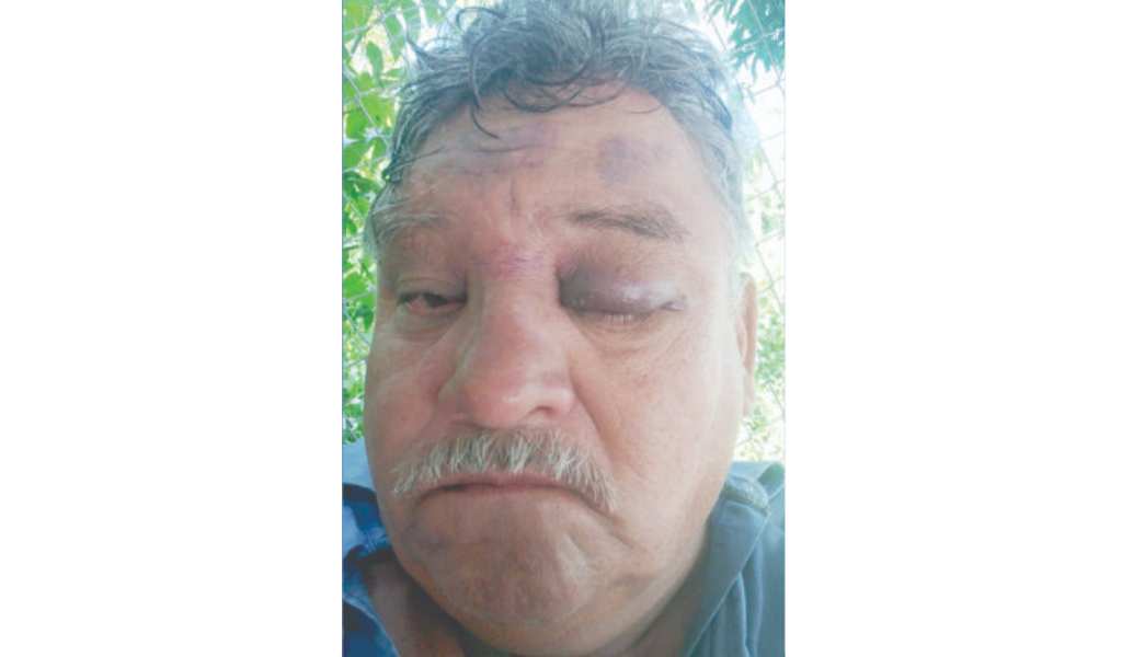 Un remisero falleció tras un violento ataque de otros choferes en Aguas Blancas: "Agonizó durante 3 semanas"