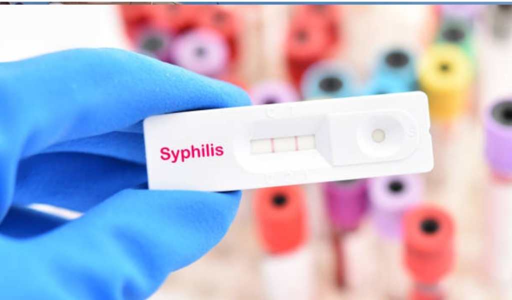 Fuerte aumento de casos de sífilis en Salta: “Ocurrió porque hubo un relajamiento en el uso de los métodos anticonceptivos entre los jóvenes"