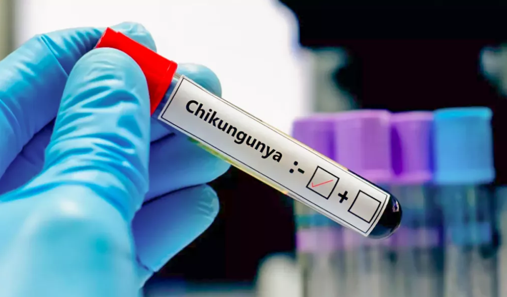 ¡Urgente! El Ministerio de Salud de Salta informó que a la fecha se registraron 30 casos de fiebre Chikungunya en la provincia