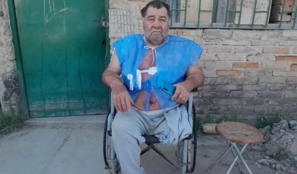 Transas quemaron con agua hirviendo a un vecino discapacitado de Orán por denunciar  la venta de drogas en su barrio
