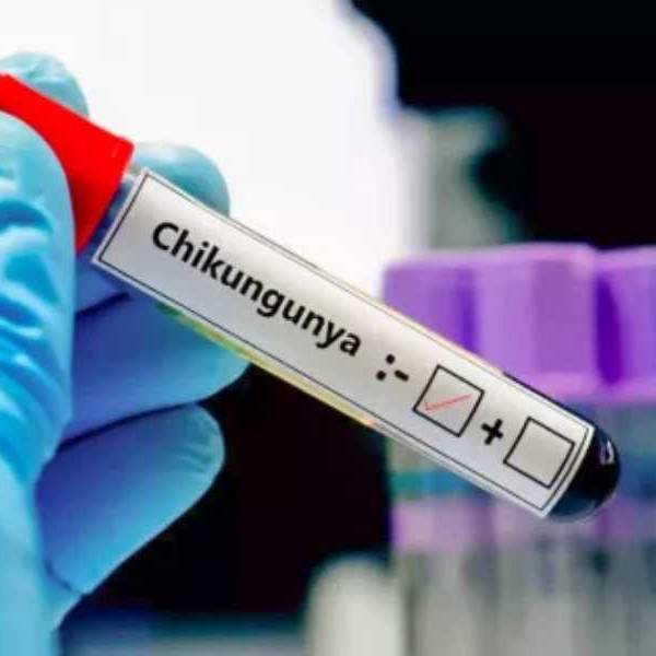 Chikungunya 