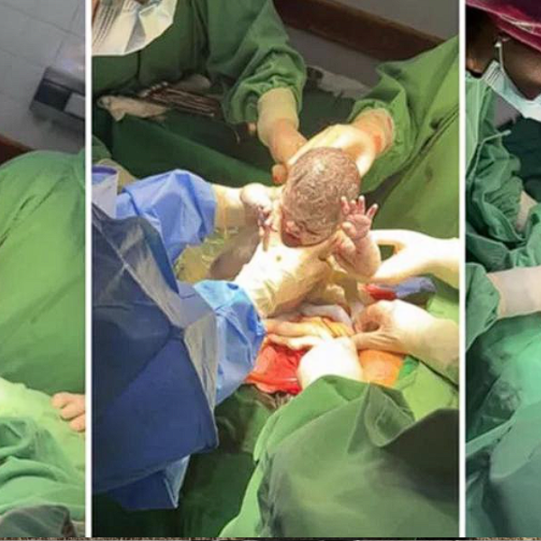 Nacieron trigemelas en Salta, un  caso que ocurre una vez cada un millón