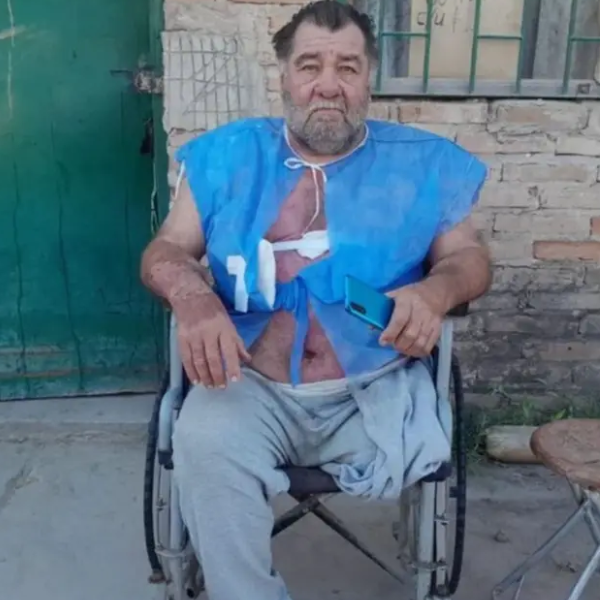Transas quemaron con agua hirviendo a un vecino discapacitado de Orán por denunciar  la venta de drogas en su barrio