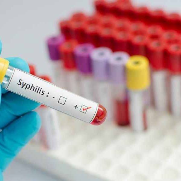En Salta los jóvenes entre 20 y 29 años siguen concentrando la mitad de los casos de sífilis