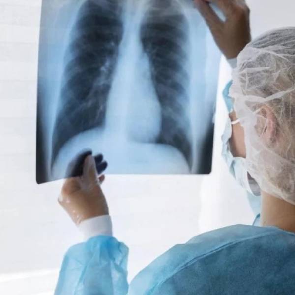Aumentaron los casos de tuberculosis en Salta: 