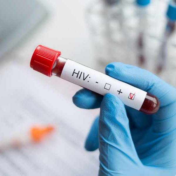 Sigue creciendo la cantidad de personas que se contagian de VIH en Salta