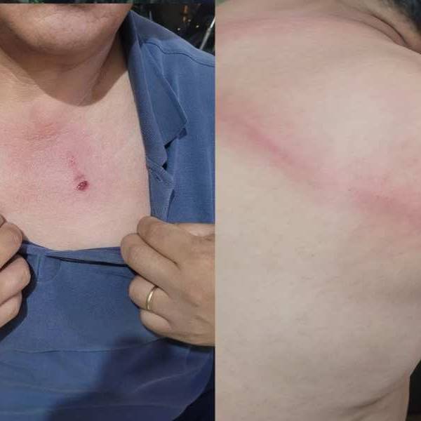 Reincidente y violento: Vendedor de pochoclos agredió con una cadena y por la espalda a un inspector municipal en Plaza 9 de Julio