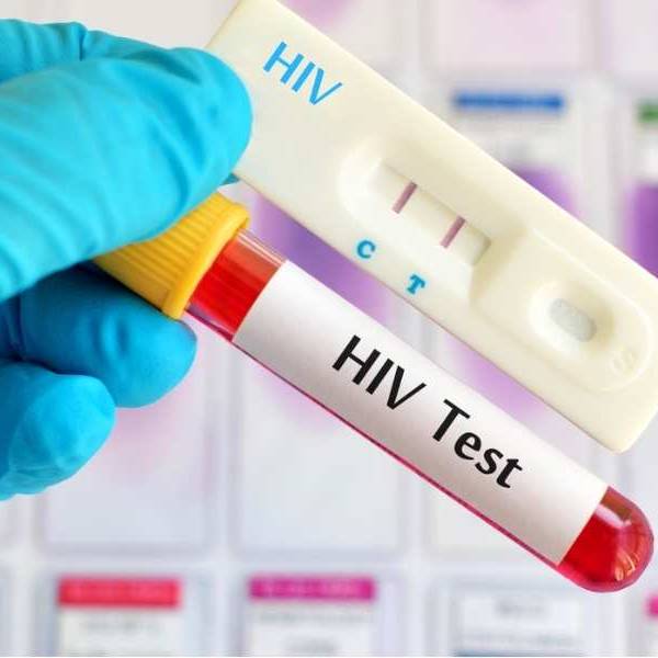 En Salta se se detectan casos de VIH e infecciones de transmisión sexual en adolescentes desde los 14 años