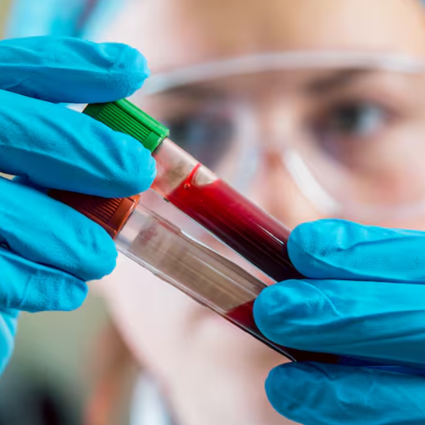 IPS  sancionará a bioquímicos que cobren plus a los afiliados: 