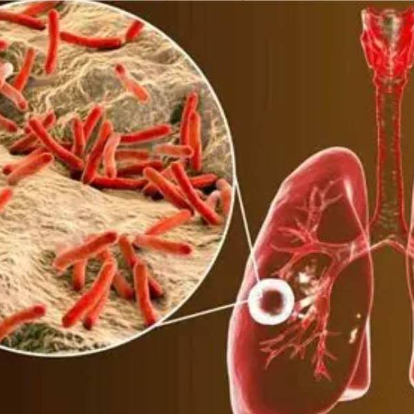 El sistema penitenciario de Salta registra 19 casos de tuberculosis en distintas cárceles: 
