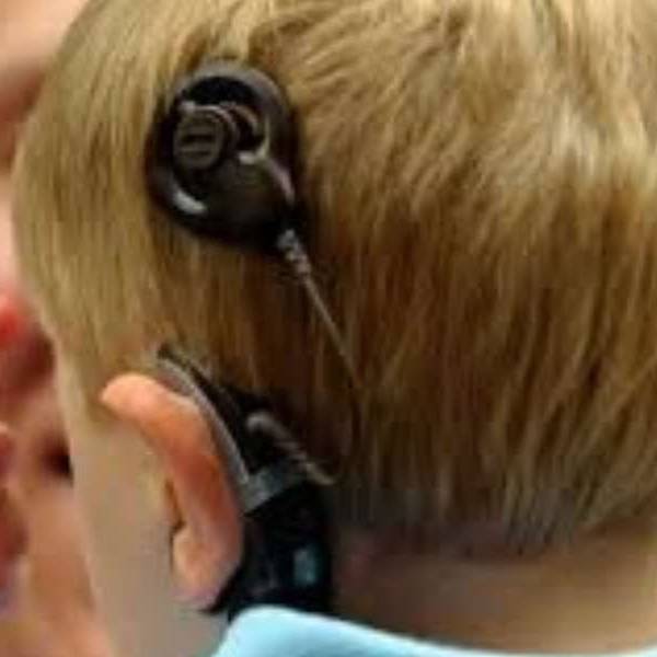 El Ministerio de Salud de Salta logró que 12 salteños sin obra social recuperen la audición en el último año a través de implantes cocleares