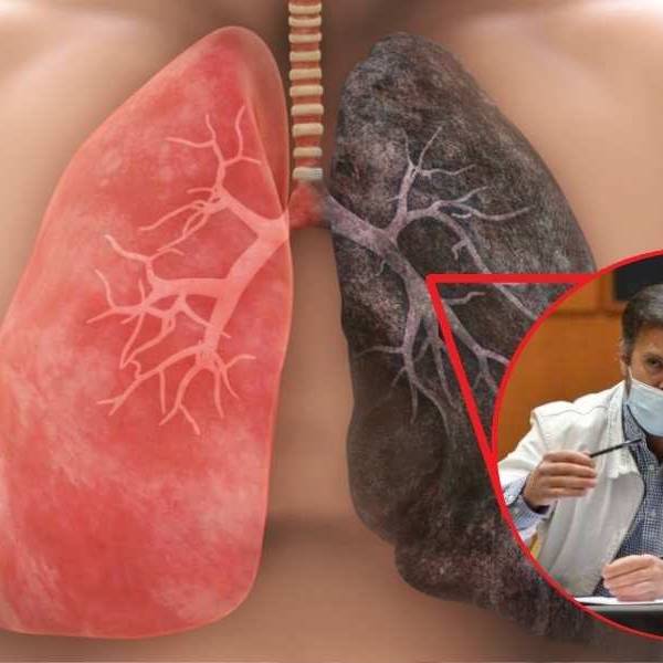 Cáncer de pulmón en Salta: Alerta por los riesgos del cigarrillo, el vapeo y el humo de leña