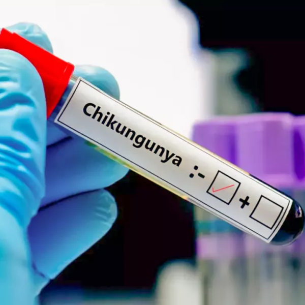 ¡Urgente! El Ministerio de Salud de Salta informó que a la fecha se registraron 30 casos de fiebre Chikungunya en la provincia