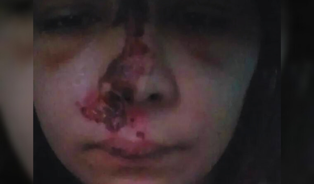 Mujer fue atropellada y abandonada en la zona Oeste de la ciudad de Salta