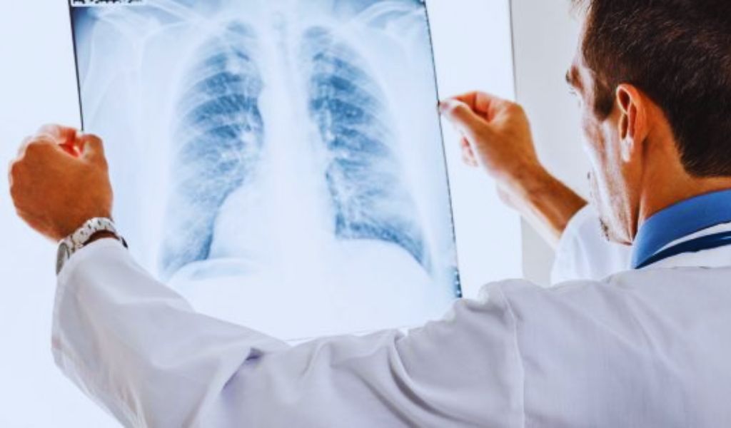 El invierno pegó durisimo en Salta: Se registraron 18 mil casos de gripe y 5100 de bronquiolitis